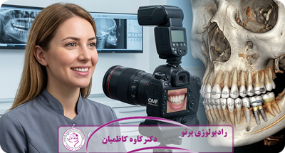CBCT در جراحی فک و صورت چیست؟ (کاربردها، مزایا و اهمیت تصویربرداری سه‌بعدی)
