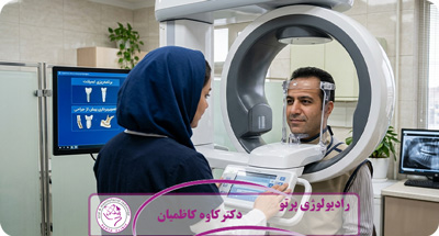 آیا CBCT برای ایمپلنت دندان ضروری است؟ (بررسی کامل قبل از کاشت ایمپلنت)